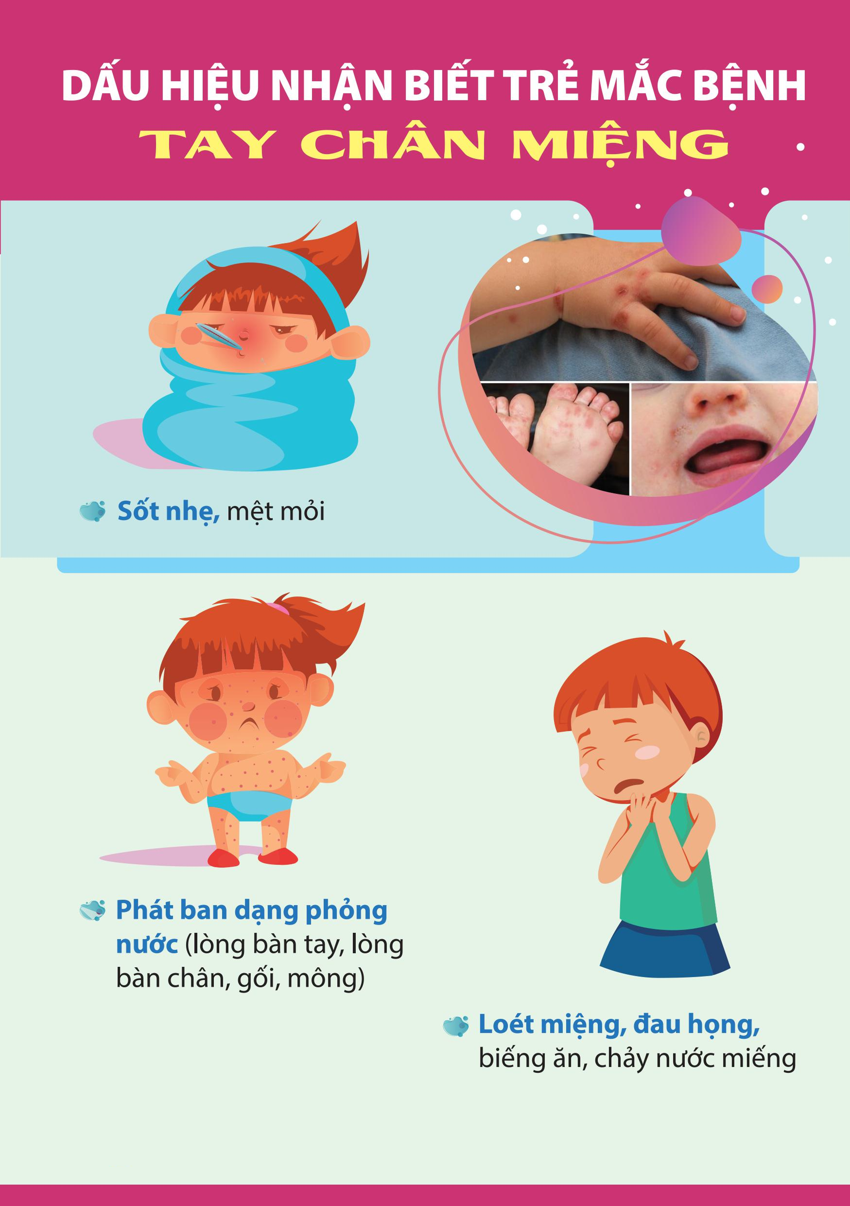 Dấu hiệu nhận biết trẻ mắc bệnh tay chân miệng