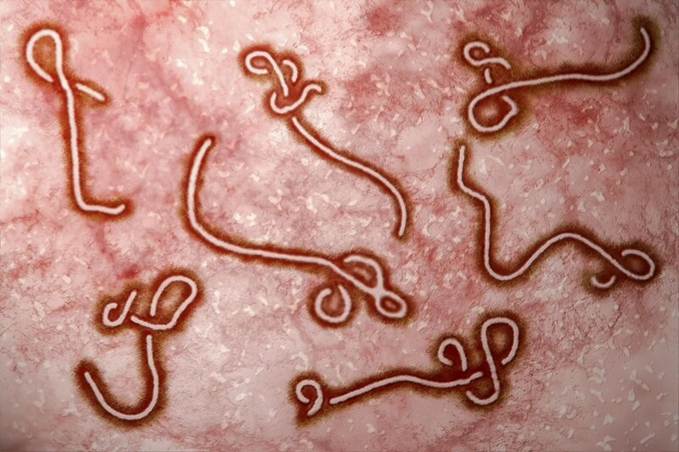 Bệnh Ebola: triệu chứng và cách phòng ngừa hiệu quả