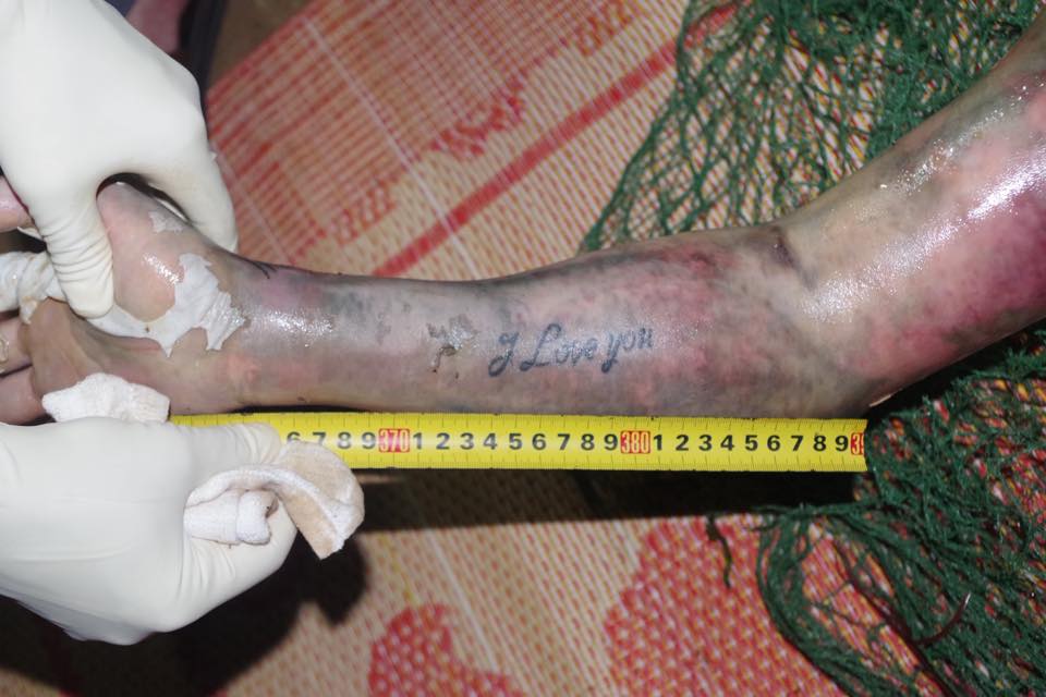 TRUY TÌM TUNG TÍCH NẠN NHÂN CHẾT CHƯA RÕ NGUYÊN NHÂN 